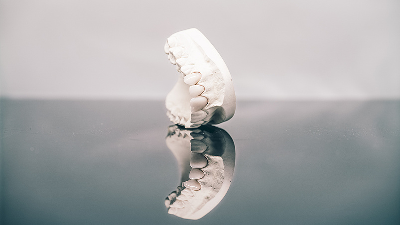 Festsitzender Zahnersatz